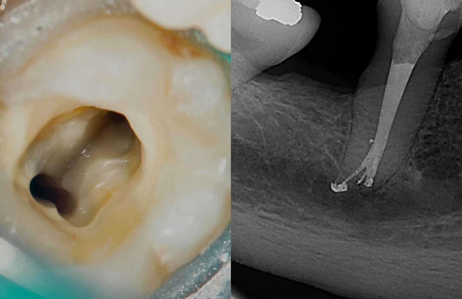 Especialista en Endodoncia